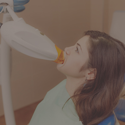 tooth whitening service tooth whitening service